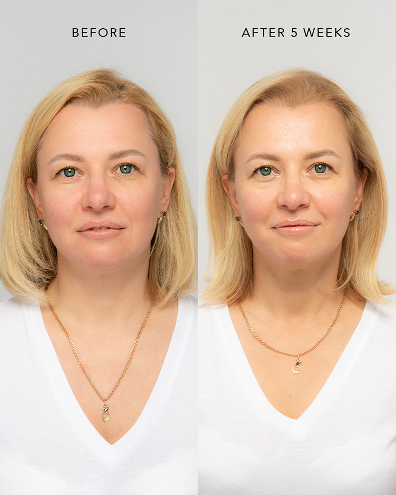 medere age-defying routine results